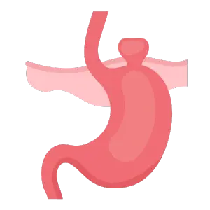 Operación de Hernias en Chetumal