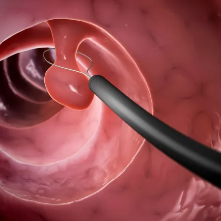 endoscopia chetumal