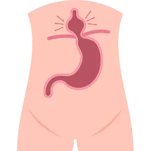 Operación de Hernias en Chetumal