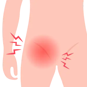 Operación de Hernias en Chetumal